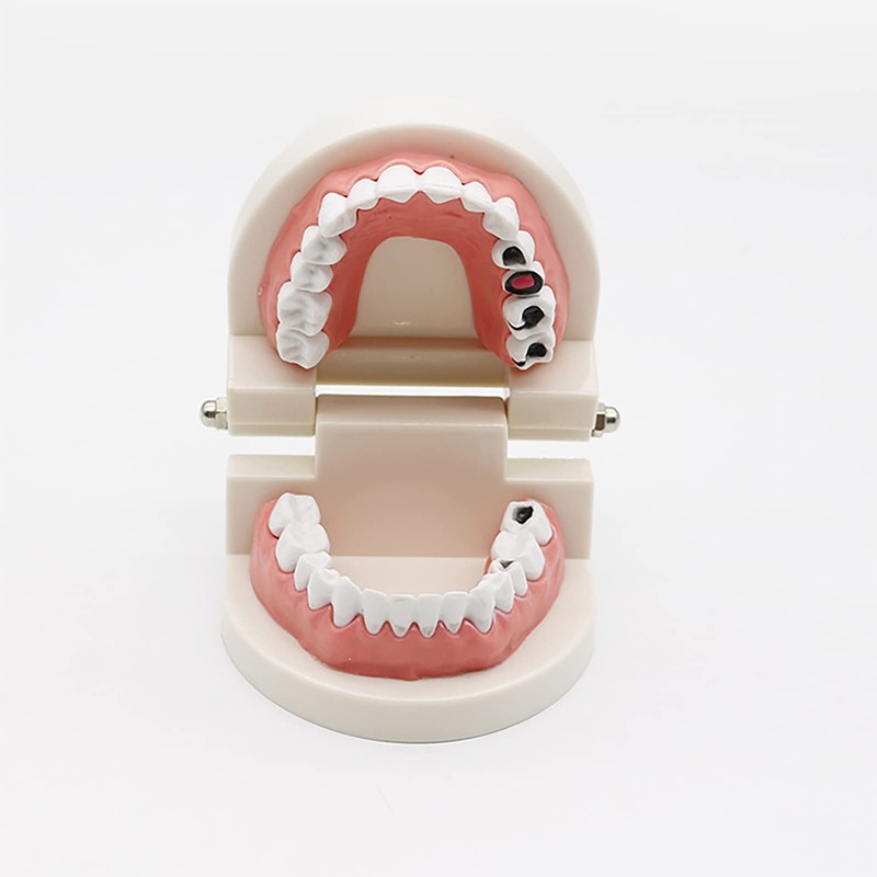 Dental Caries Study Tool Adult Standard Typodont Demonstration Teeth Model