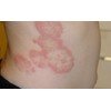 Care All 1 ANTI FUNGAL EXTRA STRENGTH 2% Cream Tube