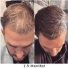 JSHealth Hair + Energy 2 Months Supply | Hair Vitamins
