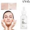 U'YAS 30ml Niacinamide Vitamin B3 Serum Cream Hyaluronic Acid Anti