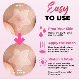 260 Parches De Espinillas Para Cara, Parches Hidrocoloides P
