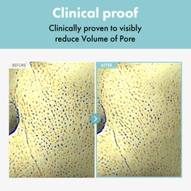 TOSOWOONG TOSOWOONG Pore Refiner Cream, Face Cream, Pore Extractor, Pore Minimize & Reducer and Remover. Best Pore Minimizer Treatment. Moisturizer for Oily Skin. K Beauty, Korean Skincare, 50g, 1.76 oz.