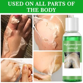 Peeling Oil for Dark Skin, Peeling Solution with Salicylic Acid, Exfoliating Peeling Oil for Body, Dull Skin, Peeling Solutions For All Skin, 110ML/3.66 OZ