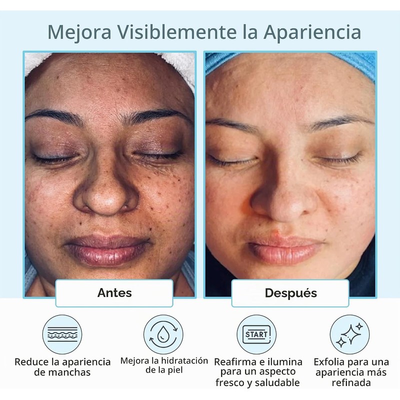 Glycolic Acid 50% Gel Peel - Enhanced with Retinol &