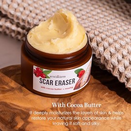 Better Shea Butter- Bálsamo borrador de cicatrices: crema de manteca de cacao para estrías y manchas oscuras, quemaduras, cicatrices antiguas y cicatrices de acné