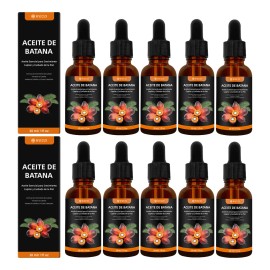 10pc Weud Battana Aceite Capilar Nutrir Para Cuero Cabelludo