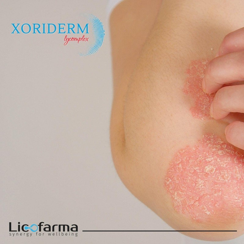 XORIDERM LYCOMPLEX Dietary Supplement for Combating Redden, Irritated and Flaky