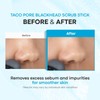TONYMOLY Tako Pore Blackhead Scrub Stick
