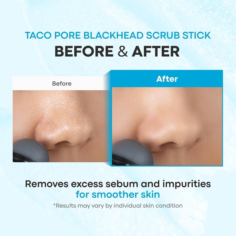 TONYMOLY Tako Pore Blackhead Scrub Stick