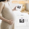 2nd Trimester Pregnancy Gift Box for Expecting and First Time
