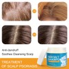 200ml Dandruff Shampoo Sea Salt Shampoo for Itching Scalp and
