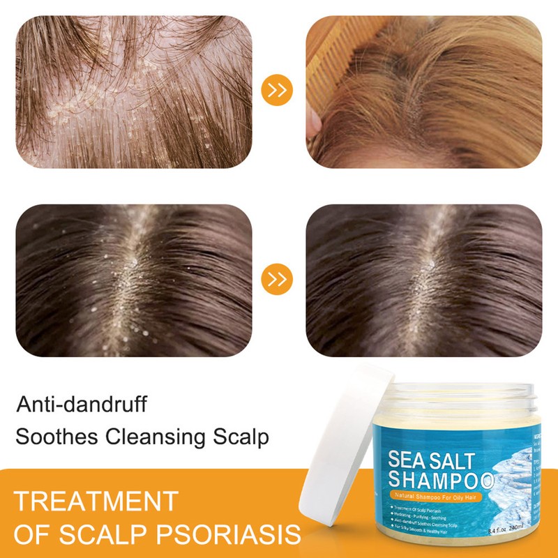 200ml Dandruff Shampoo Sea Salt Shampoo for Itching Scalp and