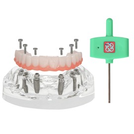 Dental Implant Model,Implant Overdenture Restoration Typodont, Maxilla All on 6 Overdenture Treatment Model,Transparent Base with 6 implants
