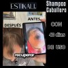 Shampoo Anticaída Anticaspa Antigraso Crecimiento De Cabello
