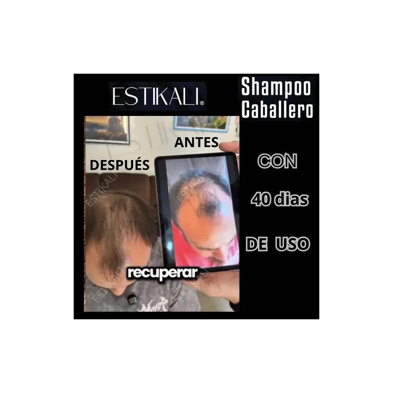 Shampoo Anticaída Anticaspa Antigraso Crecimiento De Cabello
