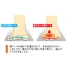 Foot Care Goods.COM Healthy Insole for Metatarsal Head Pain, Decompression