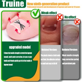 Truine Enhanced Titanium Ingrown Toenail Corrector, ingrown toenail treatment，Suitable for curved nails，ingrown toenail removal kit，at Home Ingrown Toenail Treatment，Curved Toenail Straightener(10pcs)