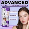 Spot Treatment Cream,Anti Pigmentation Face Cream,Pigmentation Removal Cream,Advanced Anti-Hyperpigmentation Crea-m
