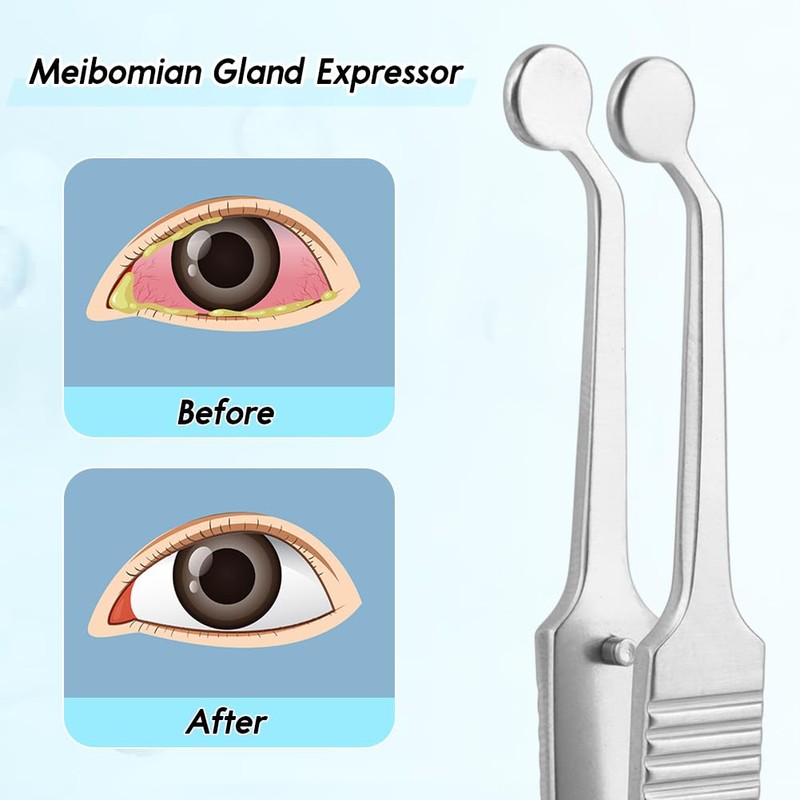 Meibomian Gland Expressor Forceps, Eyelid Gland Blockage Unblocking Physiotherapy Tools,