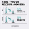 Jumiso [Jumiso]Snail Mucin + Peptide Facial Toner 205ml