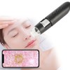WIFI 500X Scalp Detector Skin Hair Diagnosis Analyzing High Definition