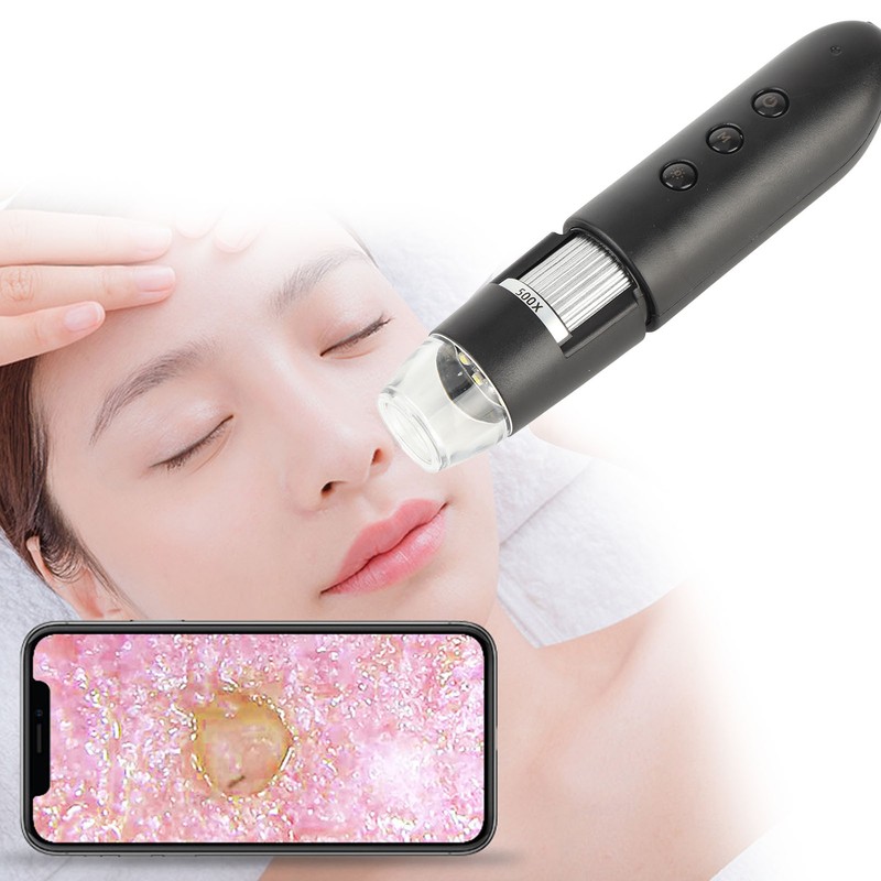 WIFI 500X Scalp Detector Skin Hair Diagnosis Analyzing High Definition