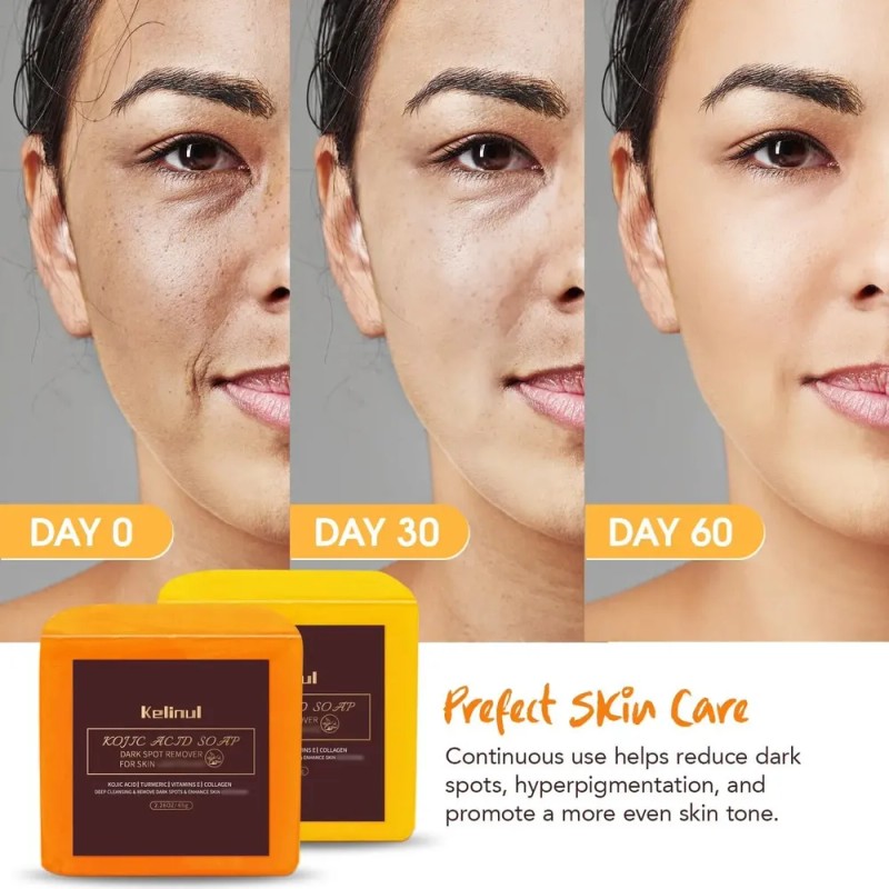 Kelinul Bath Soap Bar for Men and Women, Yellow and