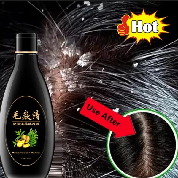 Unbranded 2025 Scalp Hair Follicle Shampoo Antibacterial Anti-Itching Mites Oil
