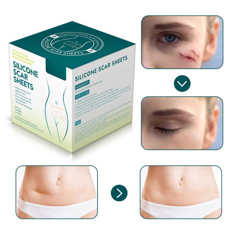 3 Meters Silicone Scar Stickers to Reduce Itching and Redness