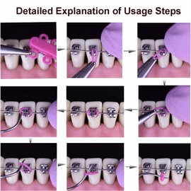 Dental Orthodontic Ligature Ties O-rings Multi-color Cat Flower Mouse Shape Rubber Bands Cartoon 1000Pcs for Homes, Beauty Salons and Clinics(Random Style）