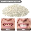 Nuanchu 100g Tooth Solid Gel Temporary Repair Kit Moldable Thermal