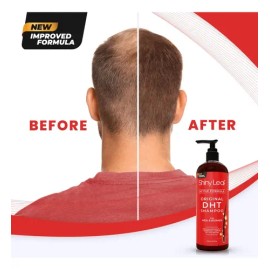 Dht Blocker Champú Anti-pérdida De Cabello Con Biotina