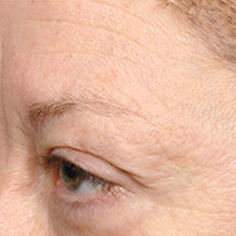 Nurse Jamie FormuL.A. Eye Cream