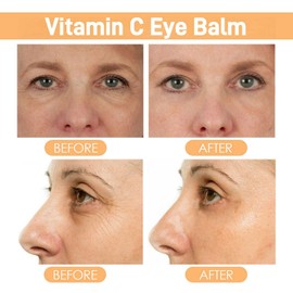 Vitamin C Eye Cream Stick,Brighten Vitamin C Eye Balm,Moisturised Glow Eye Care Stick,Anti Wrinkle Eye Cream Stick for Puffy Eyes,Cooling & Hydrating Eye Cream Moisturizer Stick,Eye Cream Anti Aging