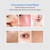 Cooling Beauty Facial Massager Pain Reduce Pore Tighten Portable Cold