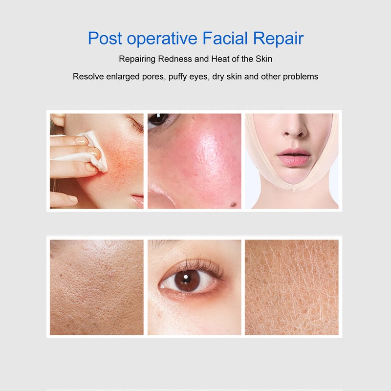 Cooling Beauty Facial Massager Pain Reduce Pore Tighten Portable Cold