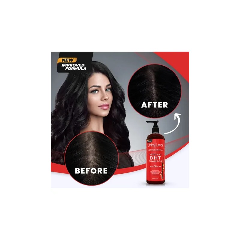Dht Blocker Champú Anti-pérdida De Cabello Con Biotina