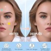 240pzs Mascarillas Estrella Para El Acne Espinillas Granos—SAVEFREE