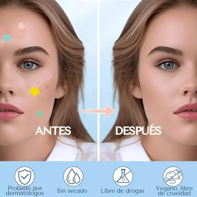 240pzs Mascarillas Estrella Para El Acne Espinillas Granos—SAVEFREE