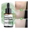 Mopoyat Suero Facial Con Ácido Salicílico 30ml