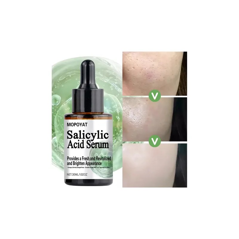 Mopoyat Suero Facial Con Ácido Salicílico 30ml