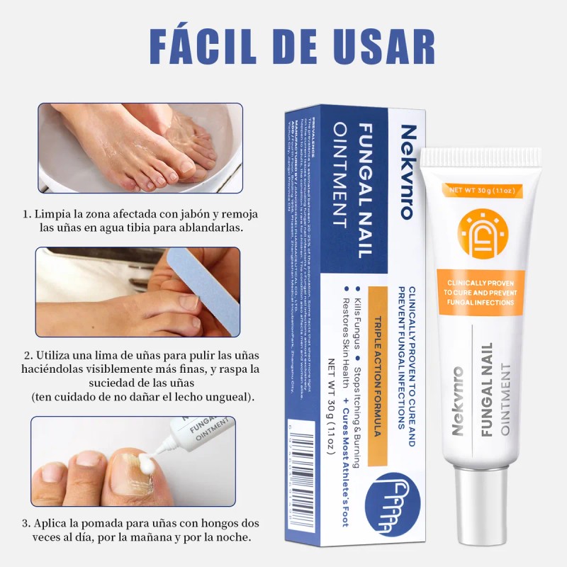 Pomada Antifúngica Para Uñas 30g,tratamiento Contra Hongos