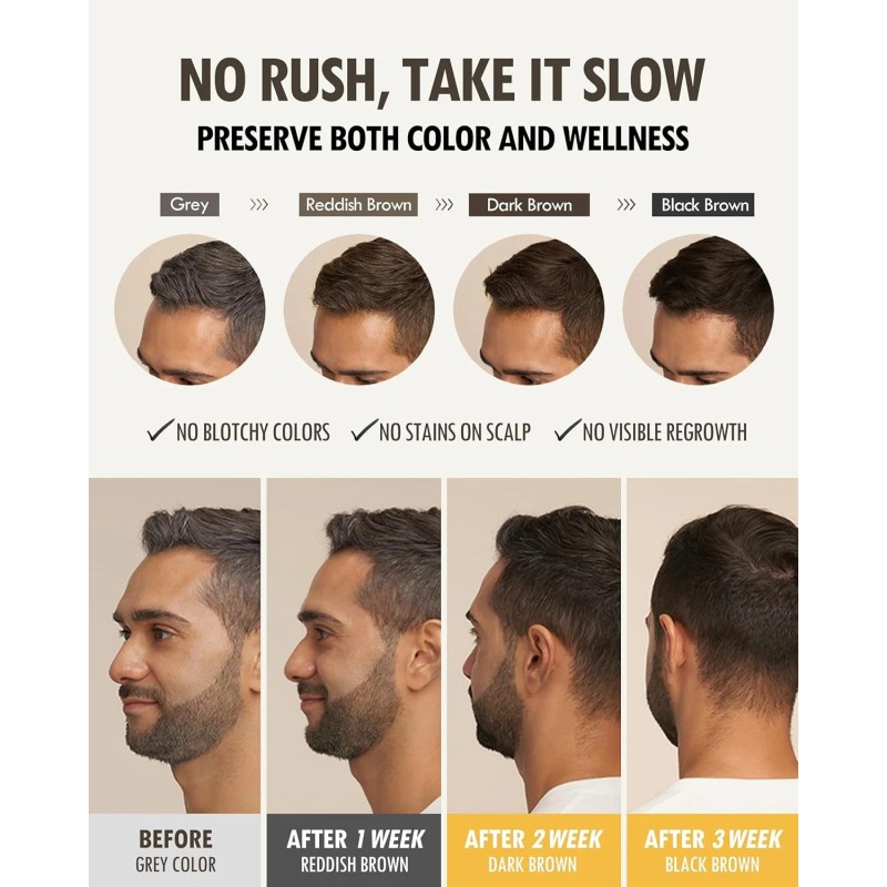 ModaModa Zero Gray Black Hair Shampoo (10.58 Oz) Natural Darkening