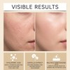 Crema facial hidratante diaria Con Colágeno centella asiática, 60g (6PCS)