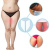WOLAIYE Thigh Inner Anti Chafing Sticker,Thighs Prevention Anti Friction Pad,Invisible