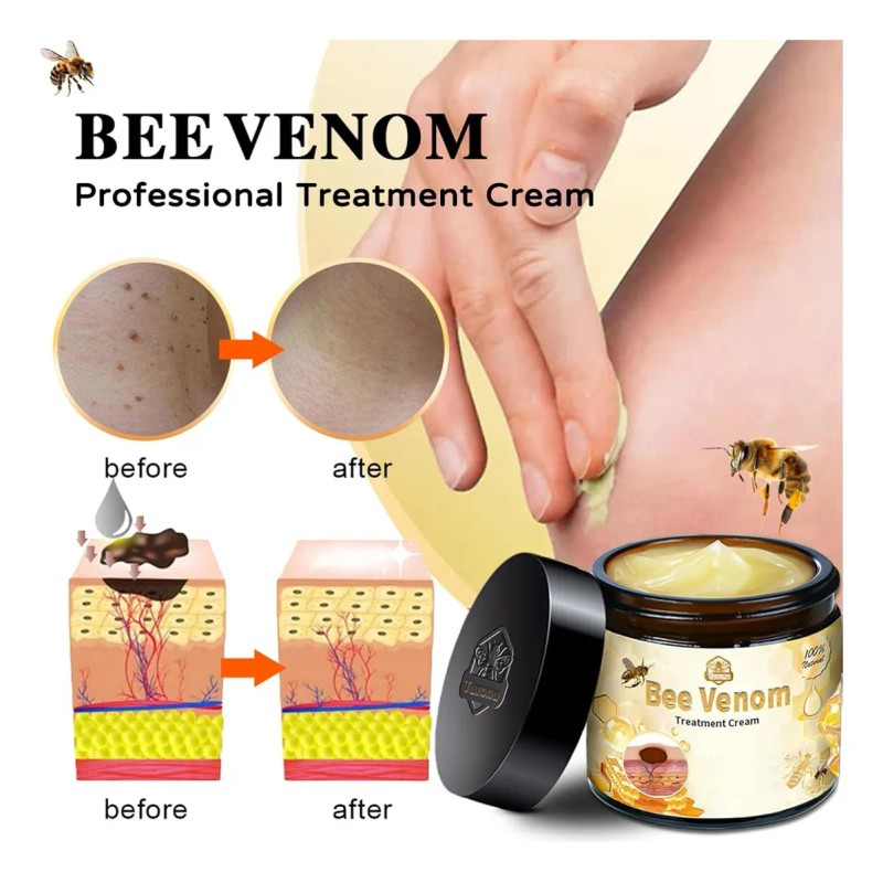 Esta Crema Suaviza La Piel, Atenúa Manchas E Jx