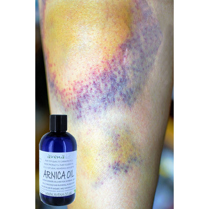 Arnica Bruise Cream Arnica Oil for Bruising Arnica Massage Oil