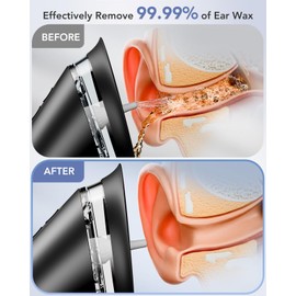 Yakbio Ear Wax Removal - Electric Ear Cleaner with LED Display, Ear Cleaning Kit Effective & Safe Ear Wax Cleaner Irrigation Flushing System, 3 Pressure Modes, 12 Tips