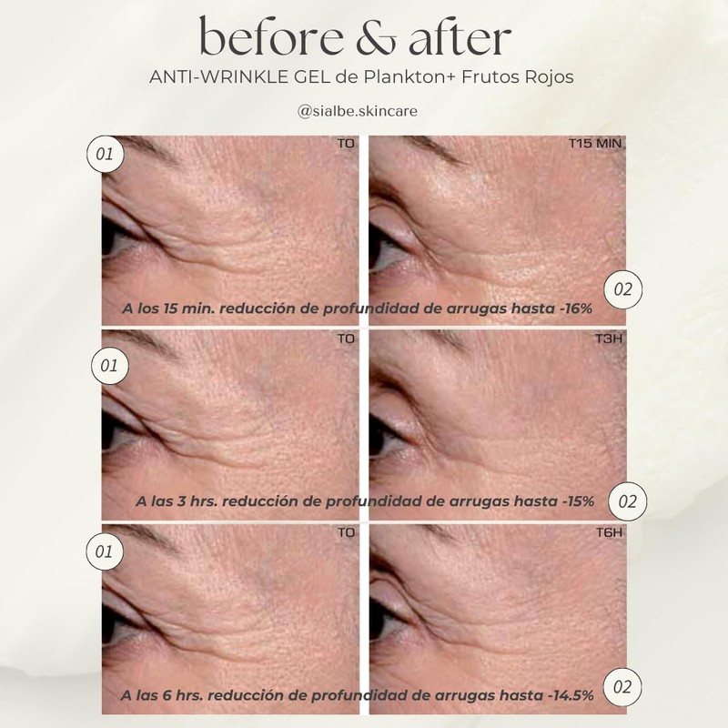 Sialbé Serum Facial con Acido Hialuronico y Vitamina C, Crema