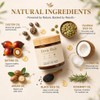 1PCSZova Hair Growth Balm,Deep Scalp Nourishing Hair Treatment